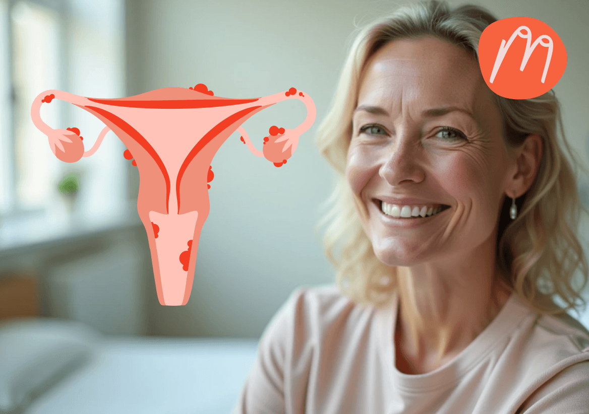 Wie eine Endometriose-Operation die Menopause beeinflussen kann
